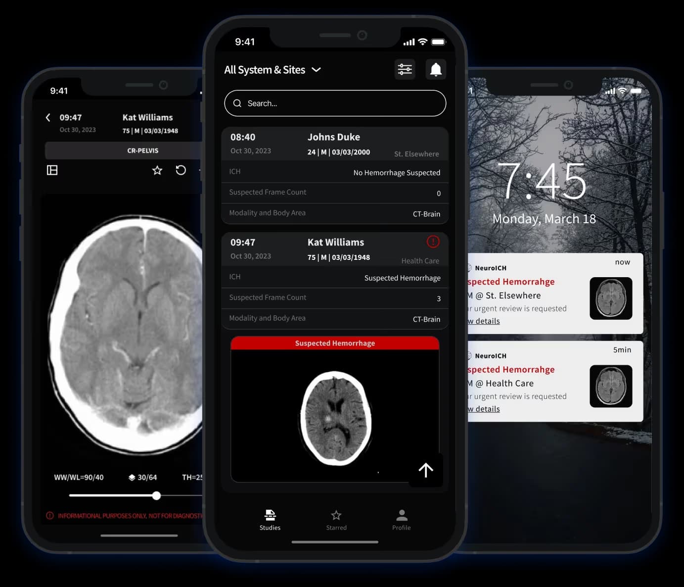 NeuroICH hemorrhage detection on a non-contrast head CT